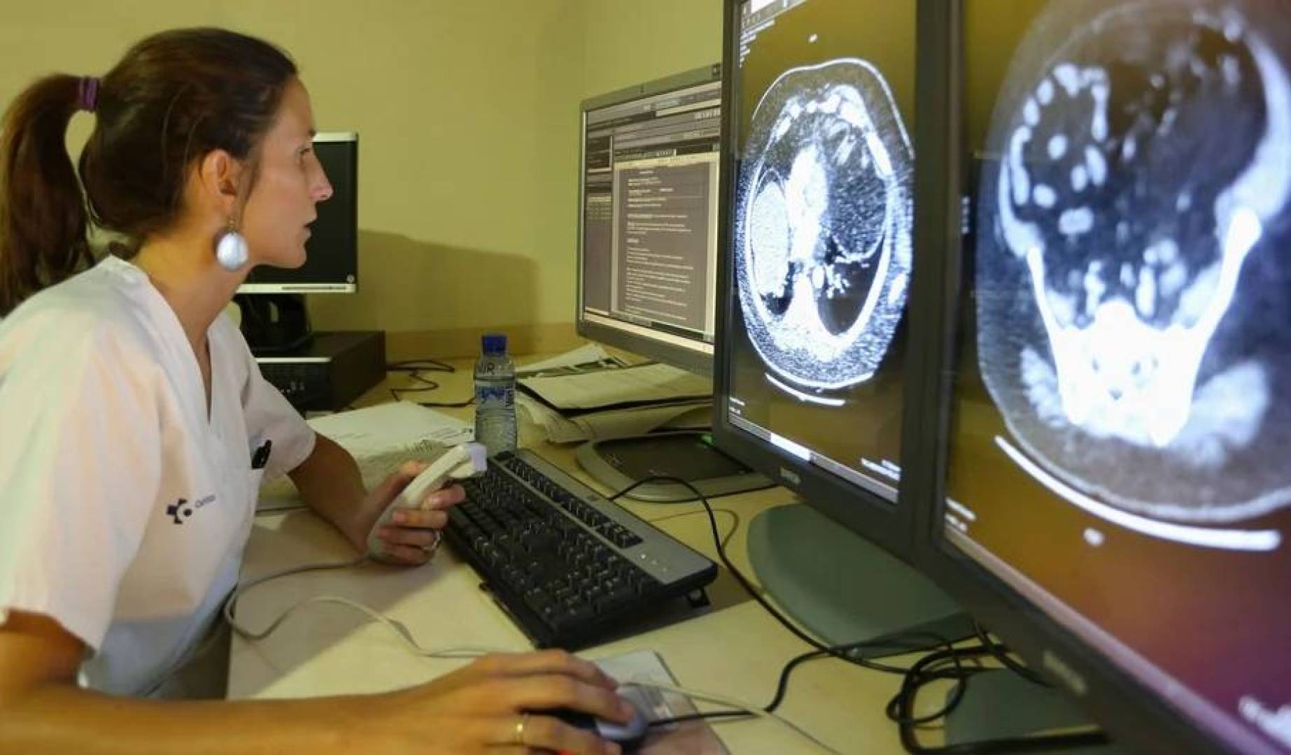 نظام مبتكر للتصوير الطبي ثلاثي الأبعاد قادر على إنتاج صور تفصيلية خلال ثوان معدودة