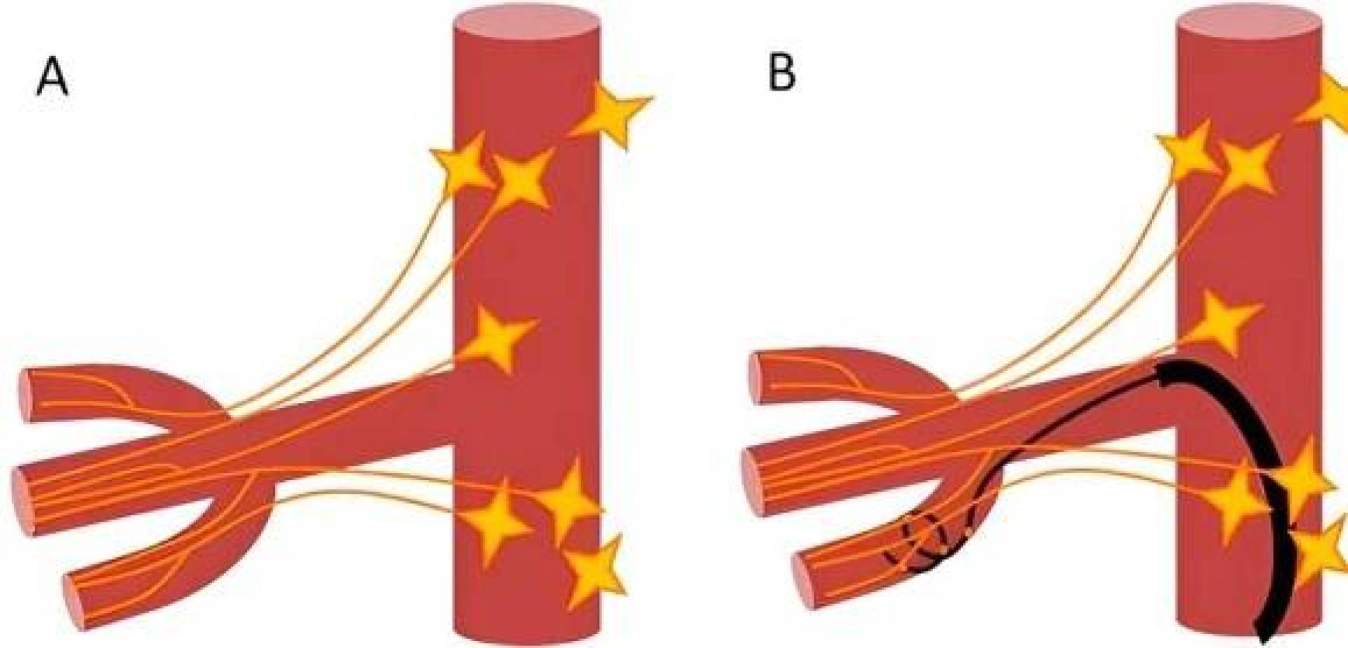 طريقة طبية جديدة تحمي الكلى لدى مرضى الضغط والسكري