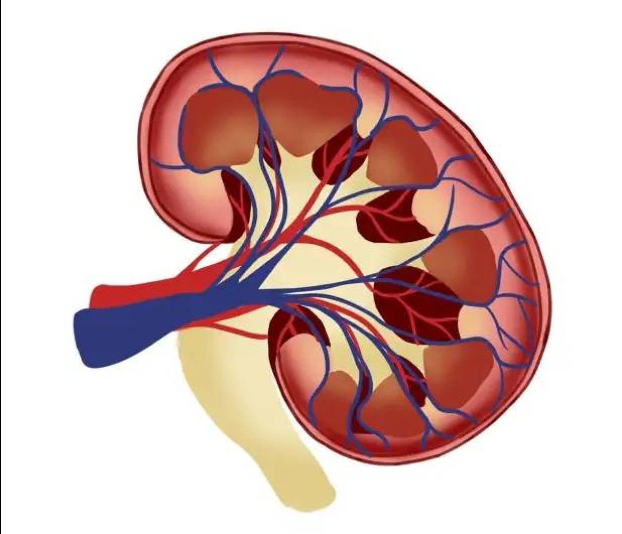 علماء يكتشفون وجود بكتيريا داخل حصوات الكلى الشائعة لأول مرة