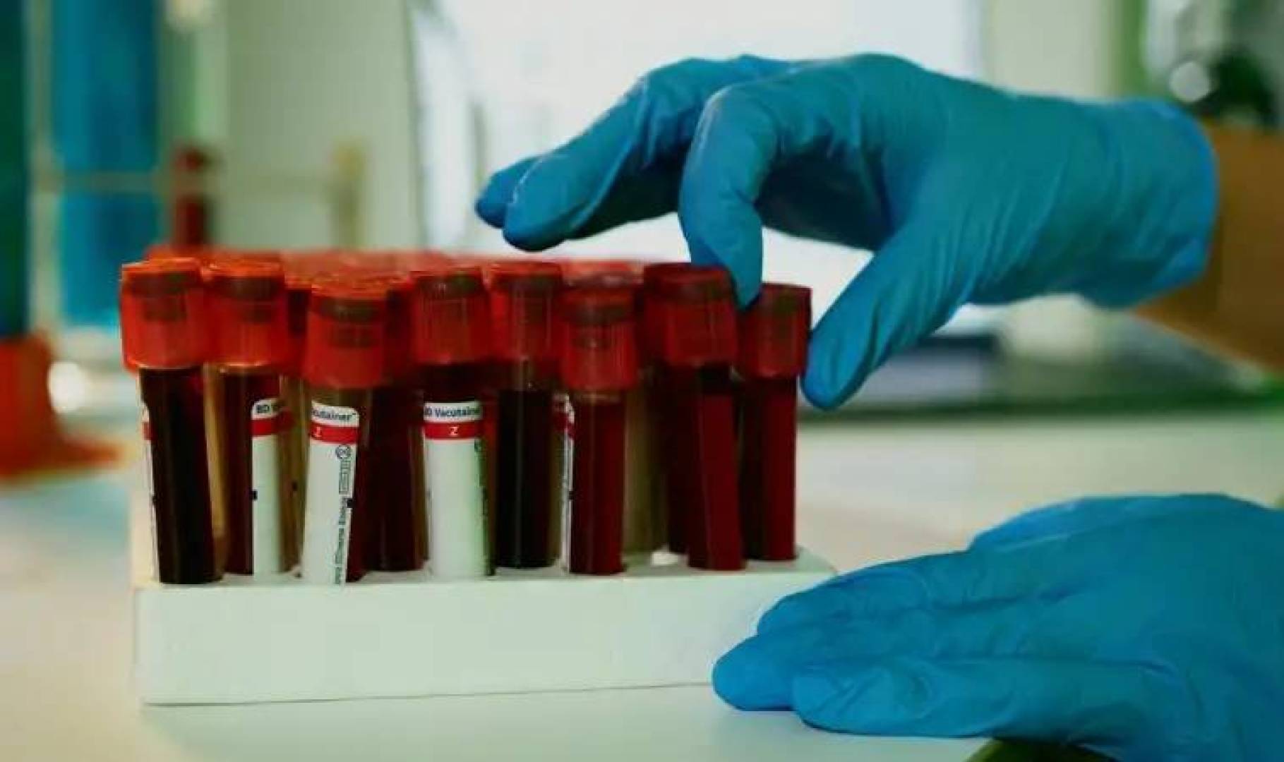 نتائج واعدة لعلاج مبتكر يحسن فرص مرضى سرطان الدم النادر