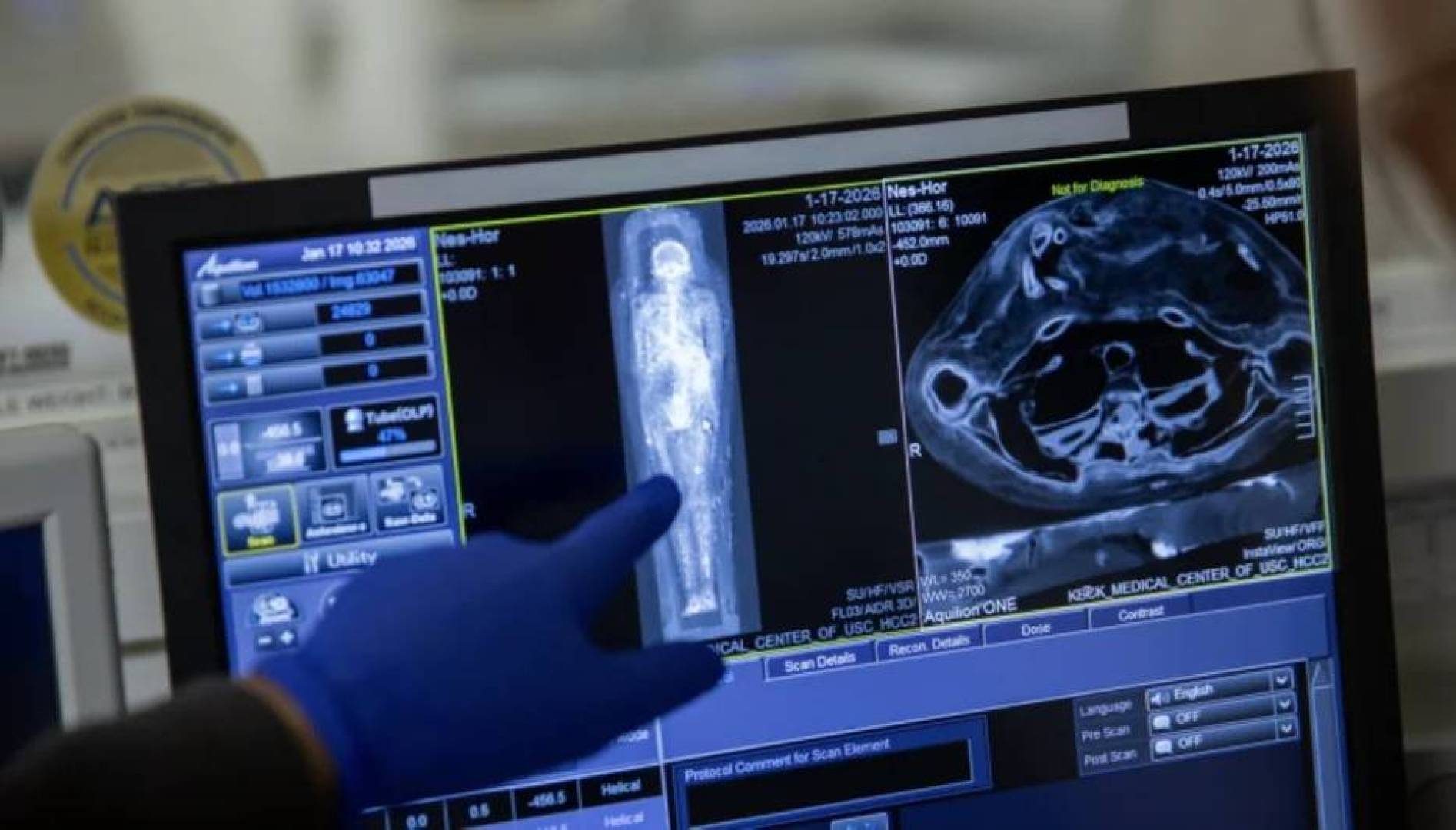 التقنيات الحديثة تكشف تفاصيل صحية عن مومياوات مصرية