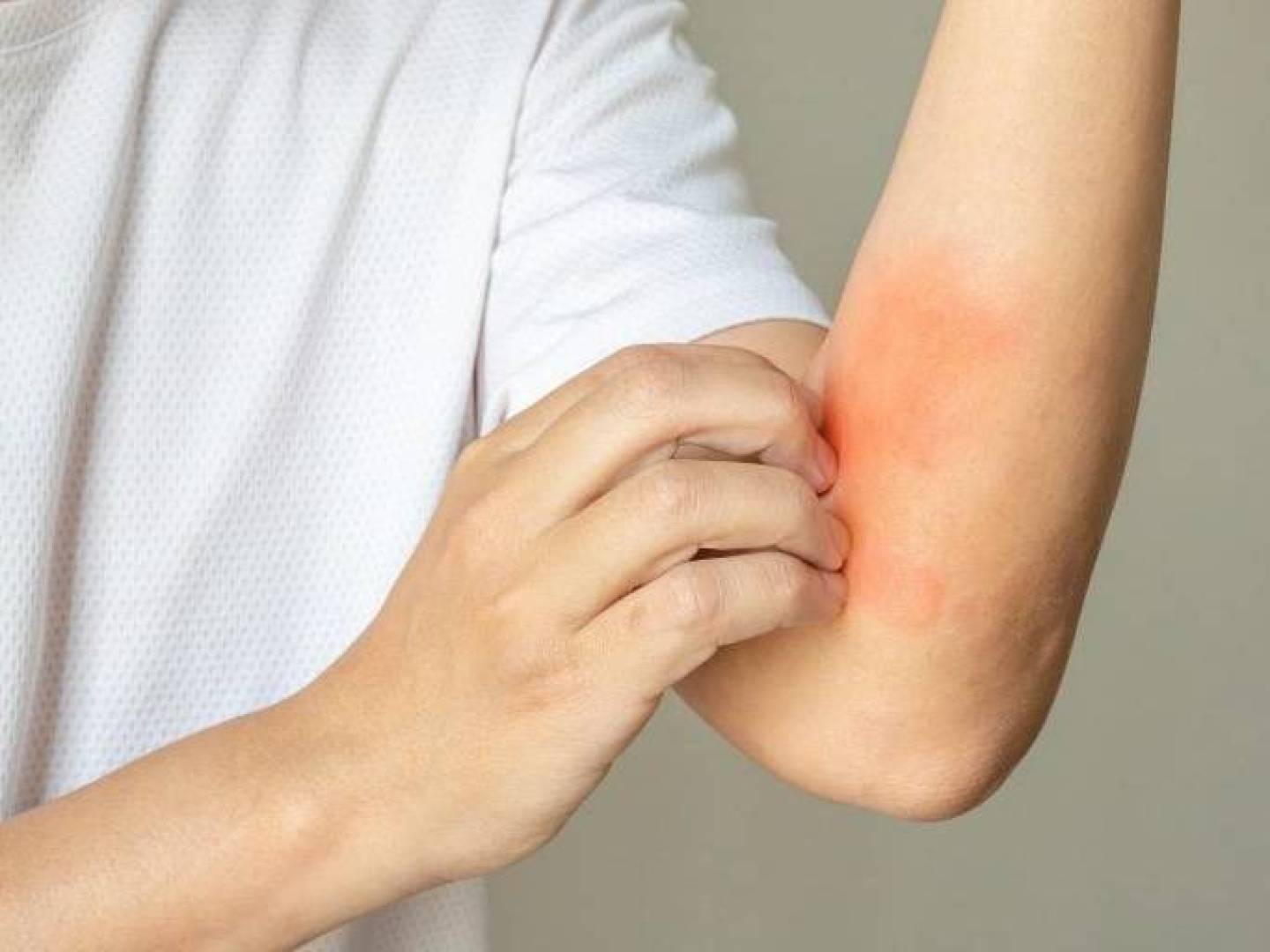 أمراض الجلد قد تكشف مخاطر نفسية خطيرة في المراحل المبكرة من الذهان