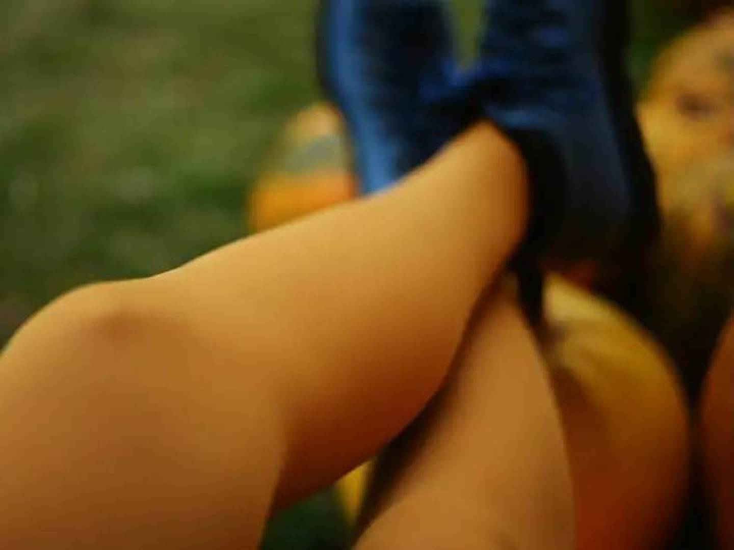 تعرف على القصور الوريدي المزمن، حالة أوردة الساقين التي تمنع عودة الدم للقلب