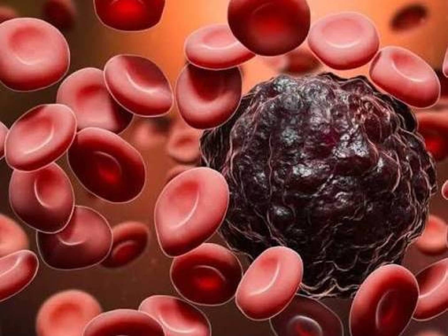 نهج علاجي جديد يرفع معدلات النجاة لدى الشباب المصابين باللوكيميا