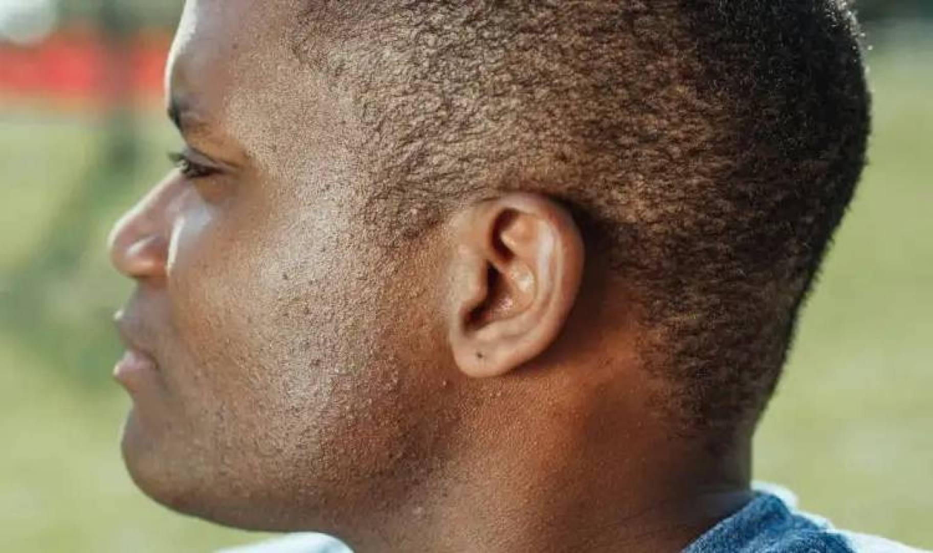 الأسباب العلمية وراء زيادة نمو وكثافة شعر الأنف والأذن مع التقدم في العمر