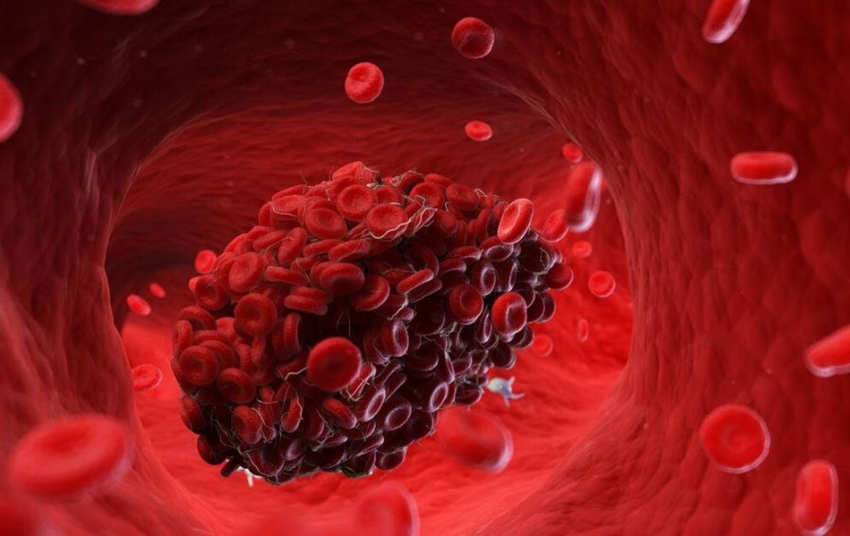 روبوت ذكي ينجح في علاج السكتات الدماغية