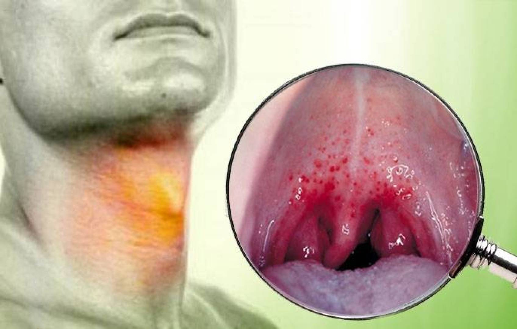 تقنية ألياف ضوئية مرنة تُحدث نقلة في جراحة أورام الحنجرة بالليزر