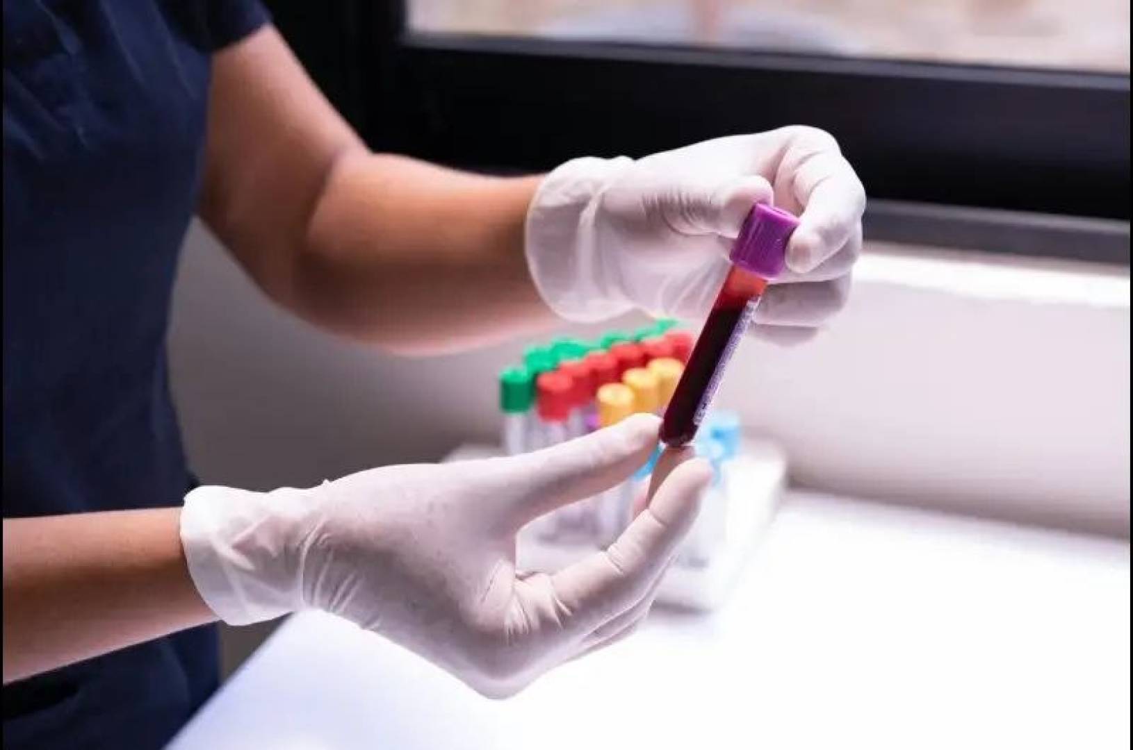 تحليل دم بسيط يرصد عدة أمراض في وقت واحد