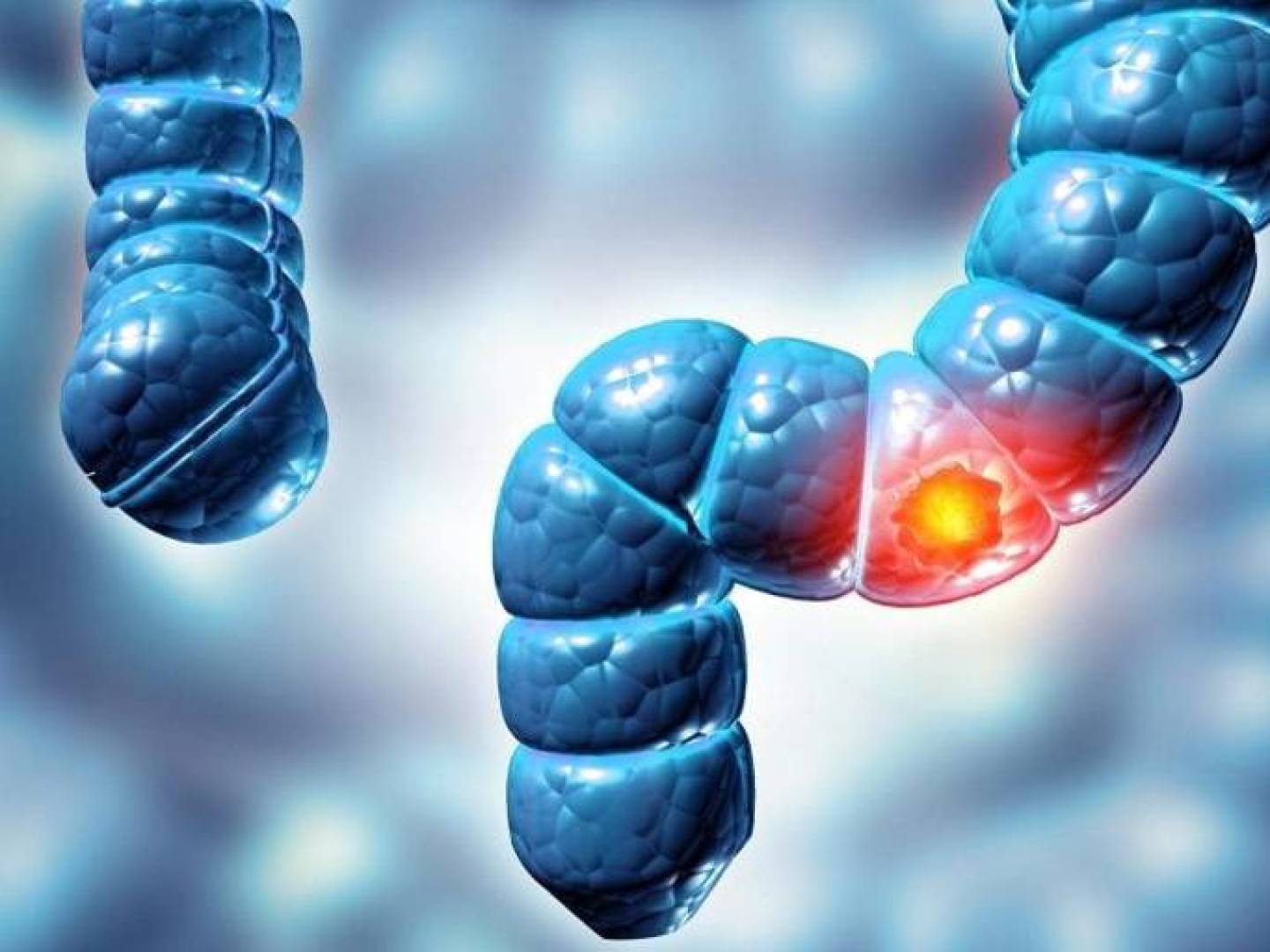 اكتشاف فيروس مخفي داخل البكتيريا قد يرفع خطر سرطان القولون