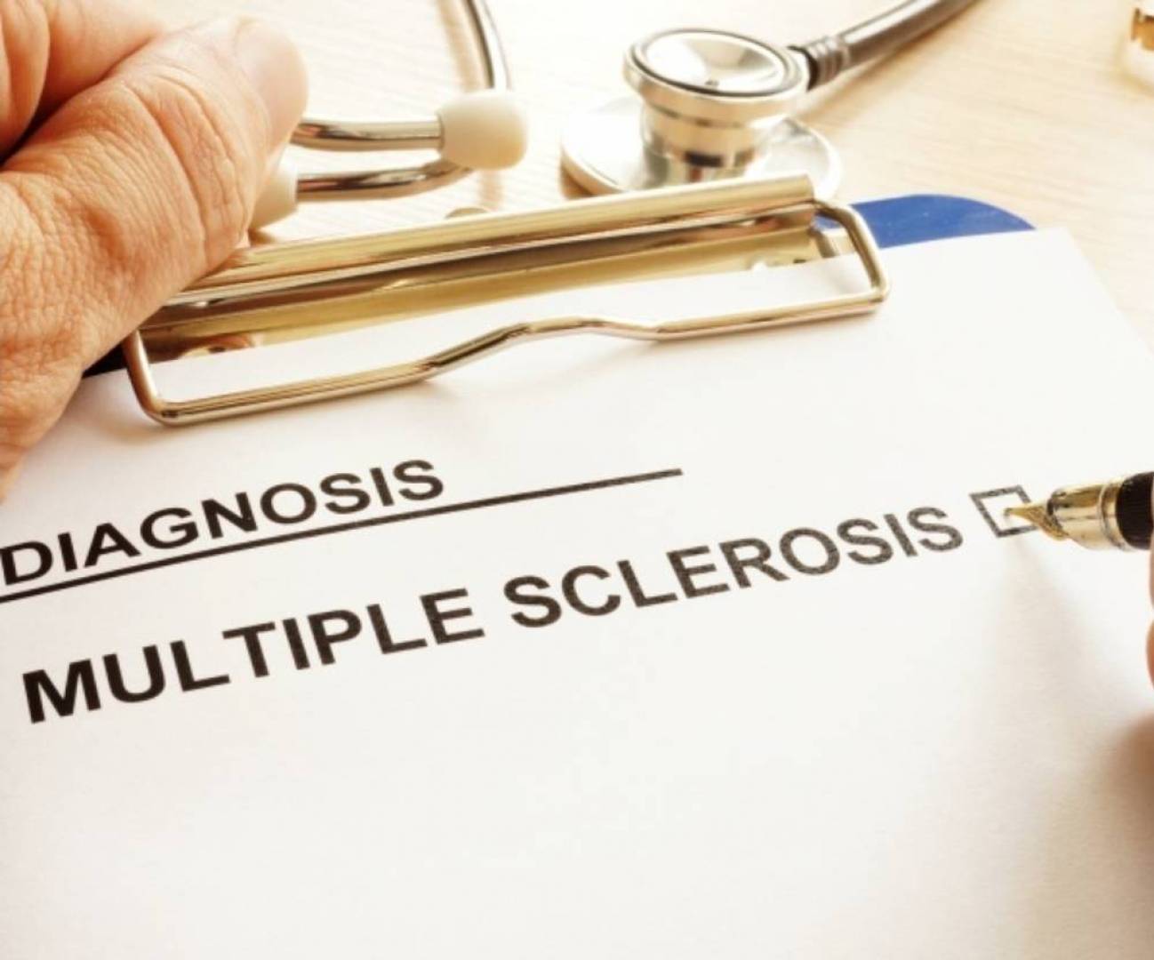 اكتشاف آلية جديدة لتلف الدماغ في التصلب المتعدد