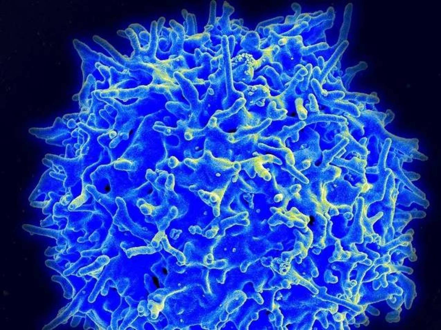 اكتشاف طريقة لإعادة تنشيط خلايا المناعة المتعبة لتدمير السرطان