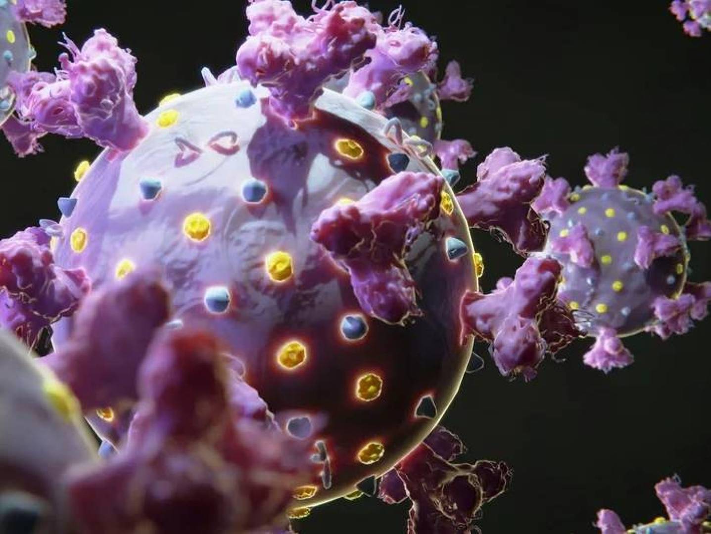 اهتزازات الموسيقى تقلل شدة سرطان الحنجرة في المراحل المتقدمة