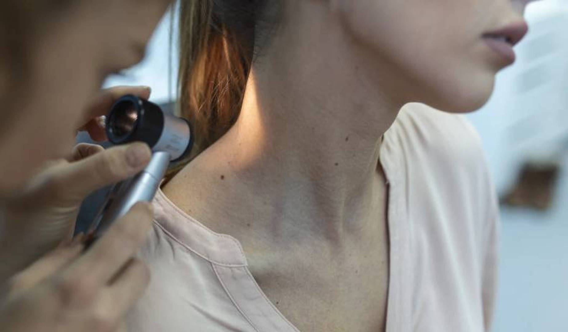 اكتشاف درع بيولوجي يحد من تطور سرطان الجلد العدواني