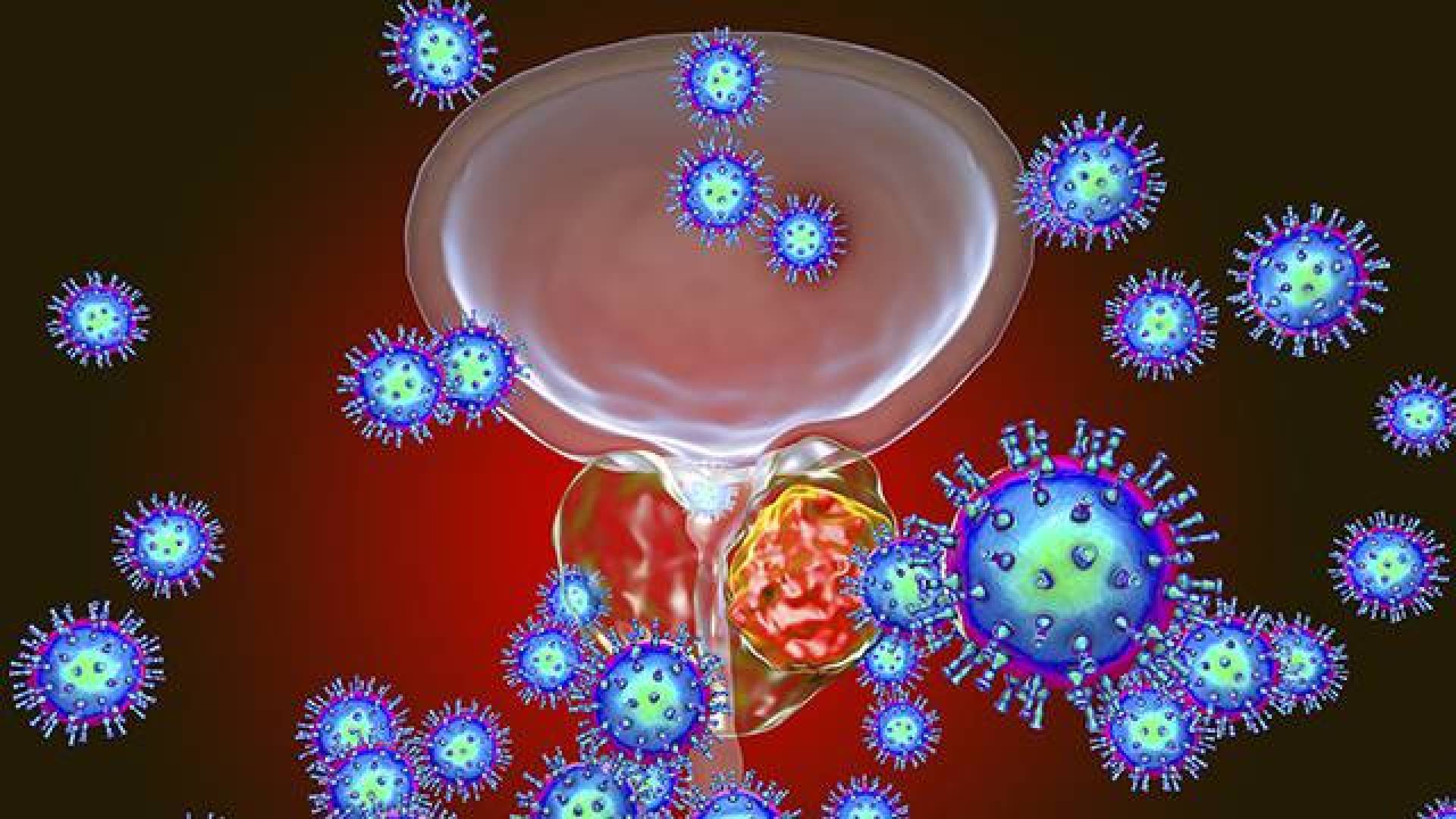 اكتشاف علاقة محتملة بين التستوستيرون وتطور سرطان البروستاتا