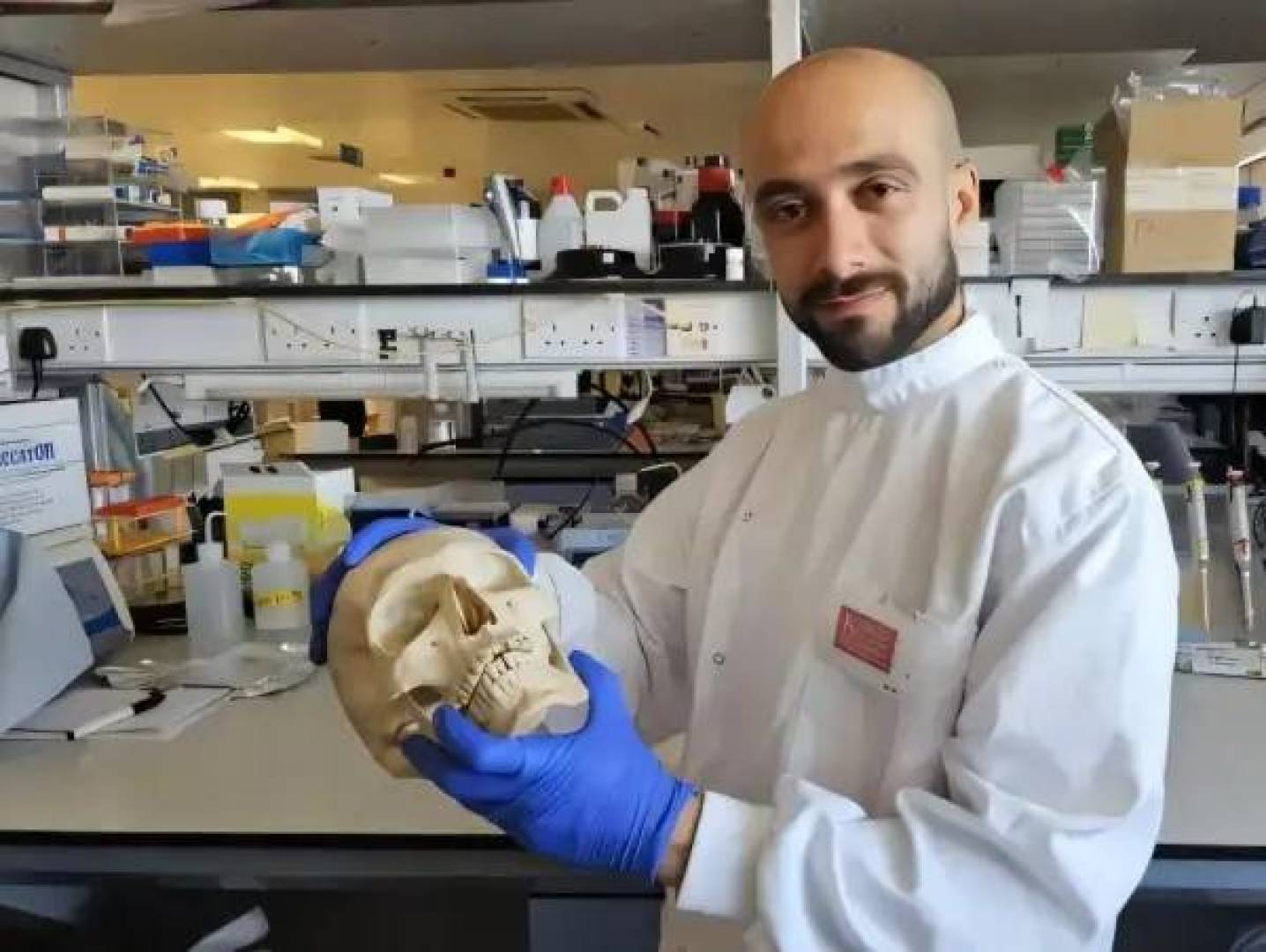 استخدام بروتين الكيراتين المستخرج من الصوف يفتح آفاقاً جديدة لعلاج كسور العظم