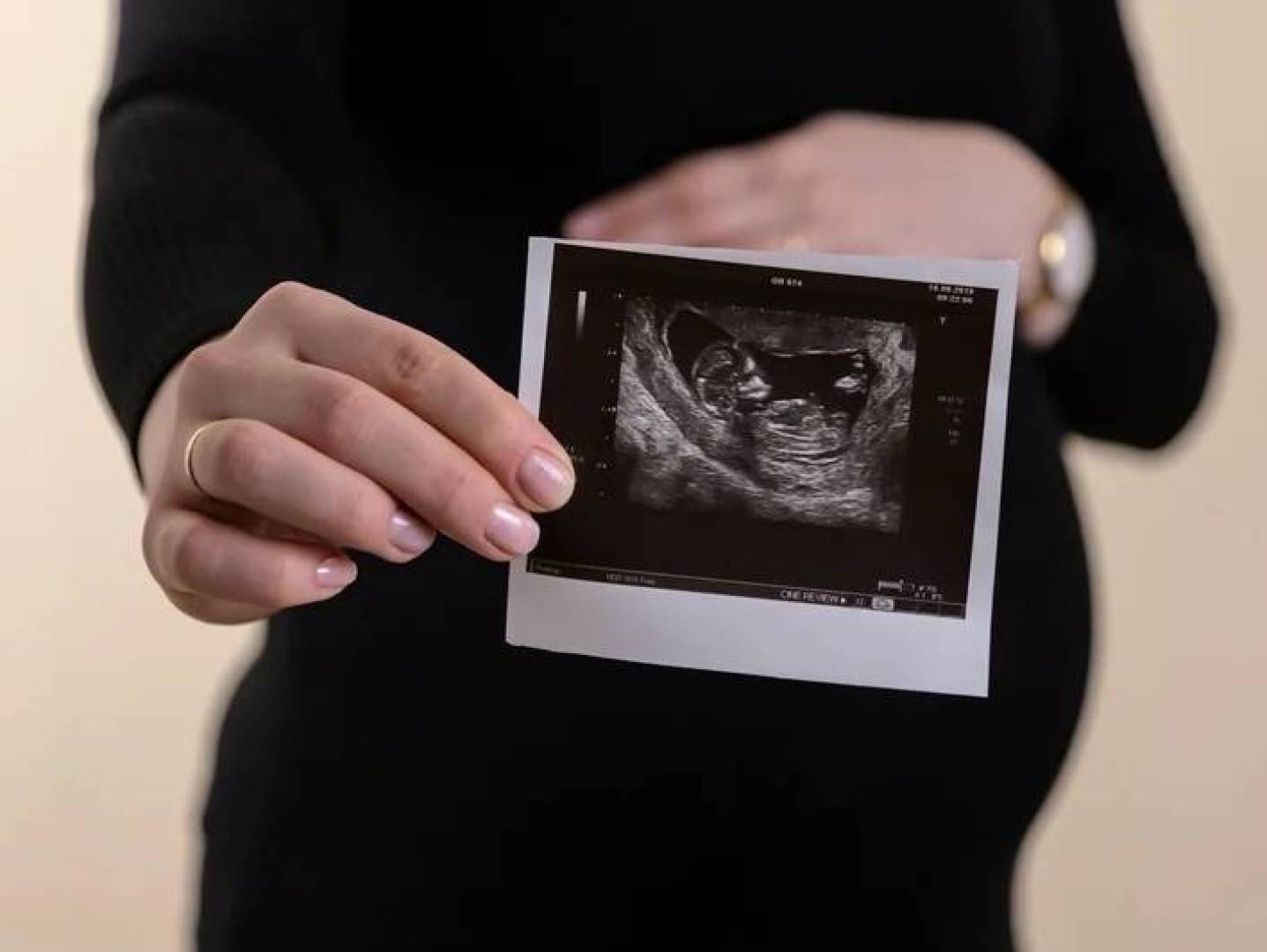 اكتشاف الأسباب الجينية الكامنة وراء الغثيان والقيء أثناء الحمل