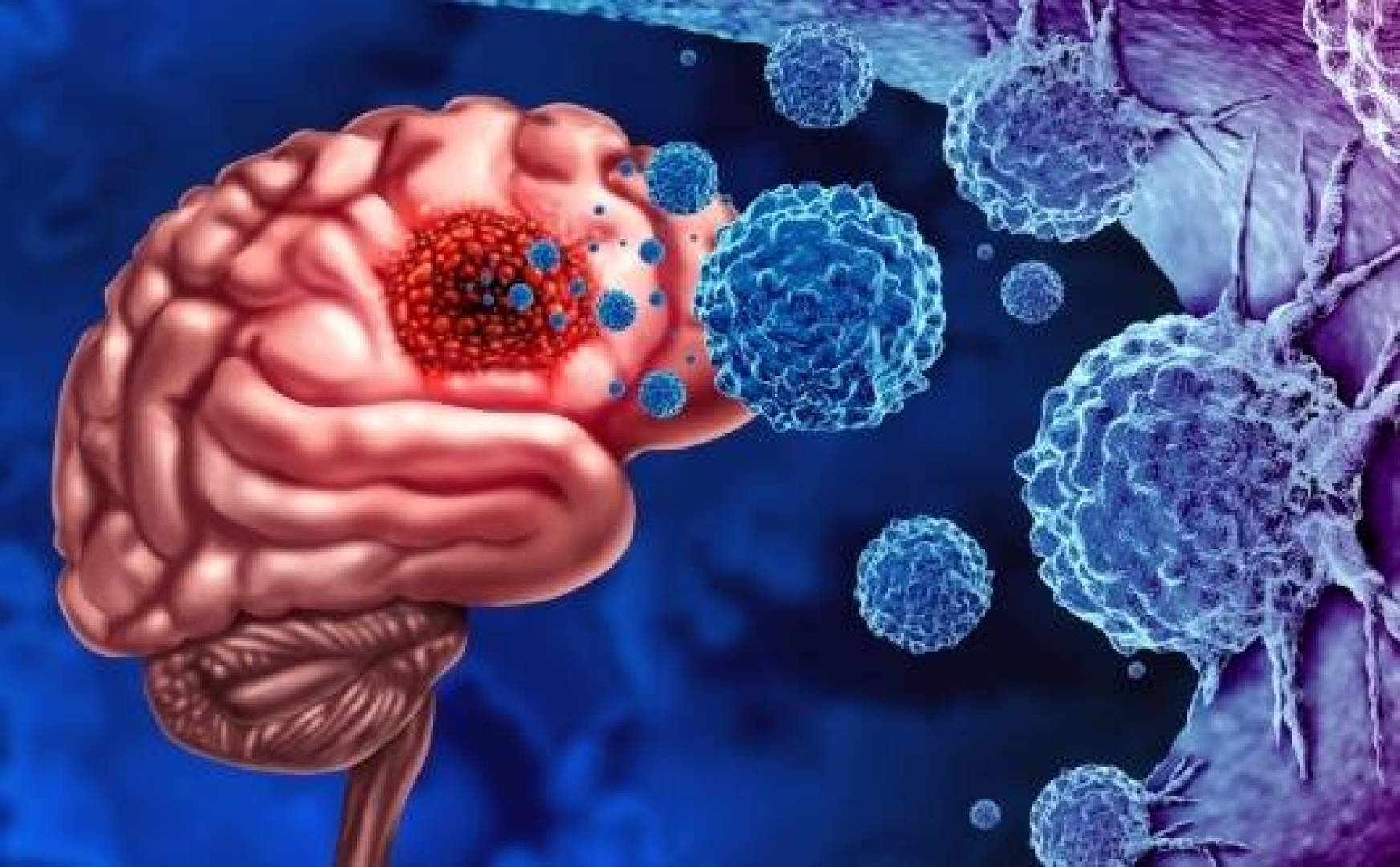 اكتشاف جزيء جديد يعزز علاج أخطر أنواع سرطان الدماغ