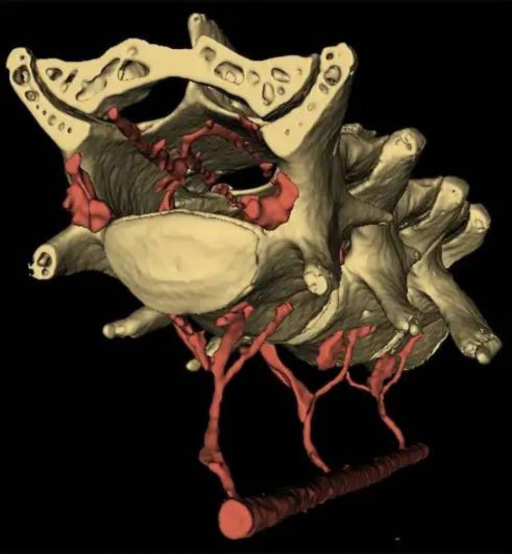 تأثير حركة الجسم على حركة السوائل داخل الدماغ و تحسين صحة الدماغ