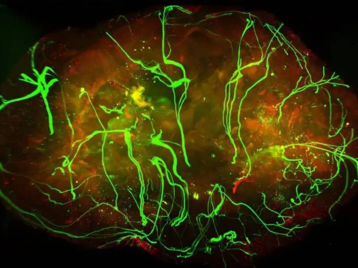 أعصاب الجلد قد تبطئ نمو سرطان الميلانوما