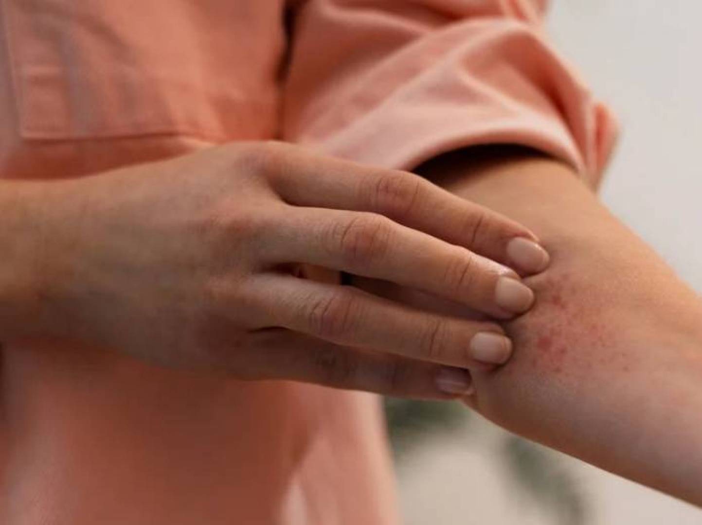 اضطرابات النوم لدى مرضى الإكزيما قد تؤثر على الذاكرة والتركيز