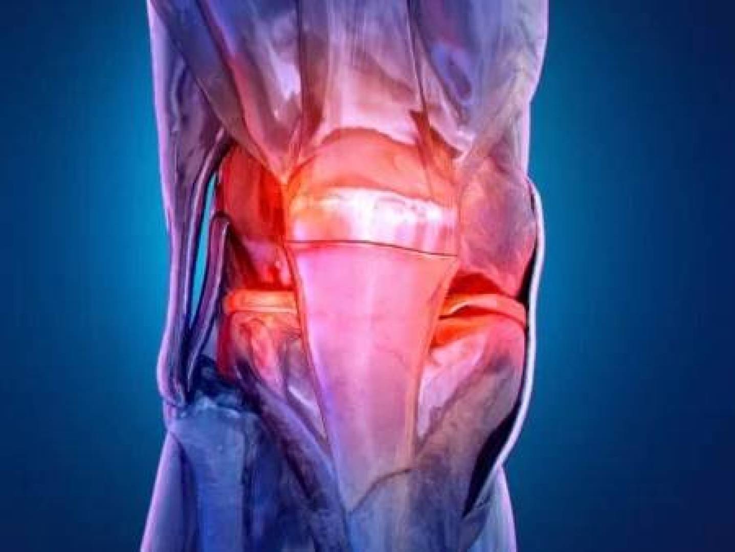 تقنية جديدة تساعد مرضى خشونة المفاصل على الحركة دون ألم