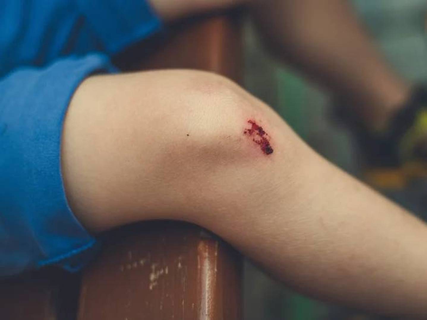 الكشف عن سر اختلاف سرعة التئام الجروح بين الأشخاص