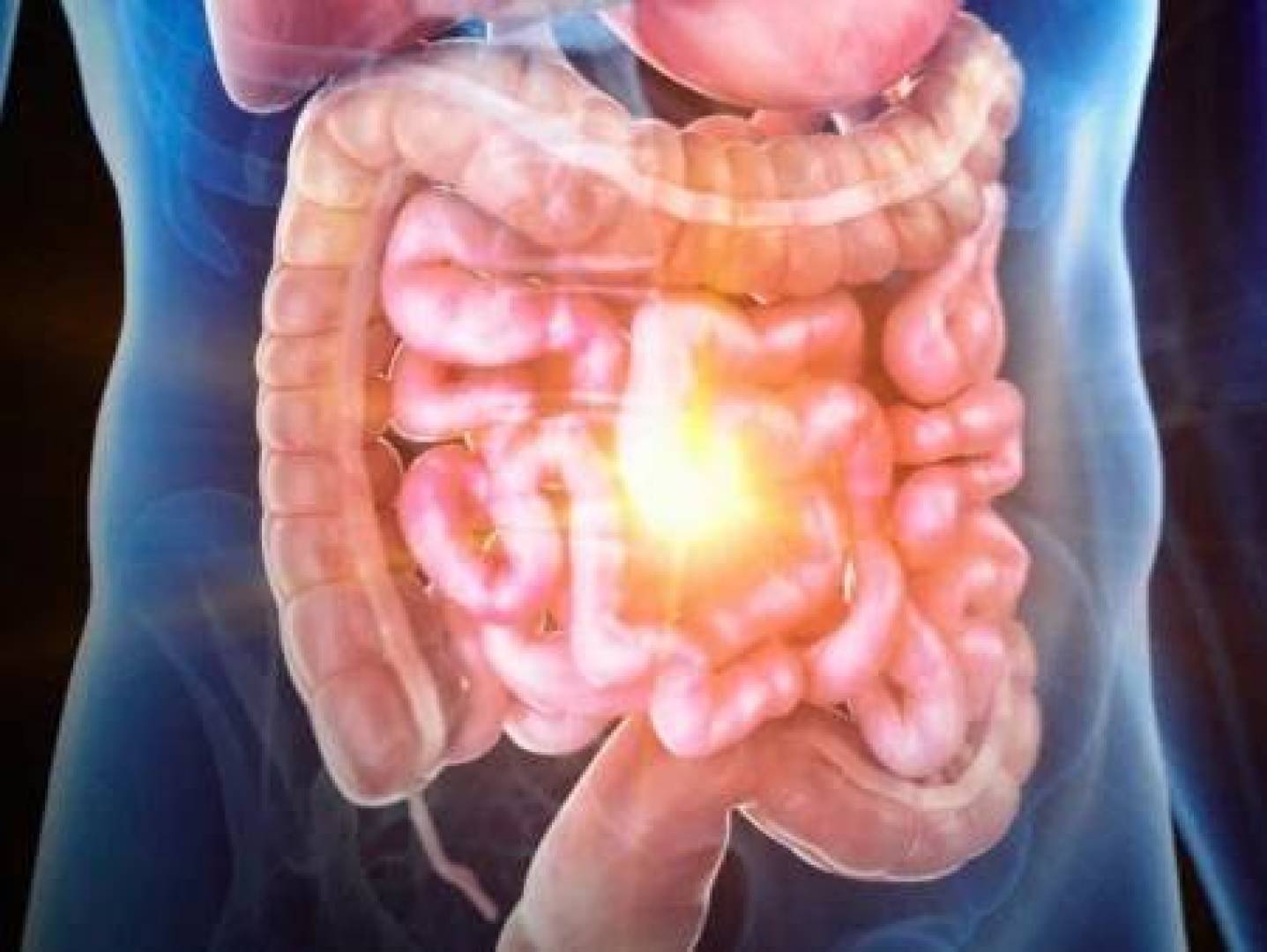 شريحة تحاكي الأمعاء البشرية لفهم التهاب الأمعاء المزمن