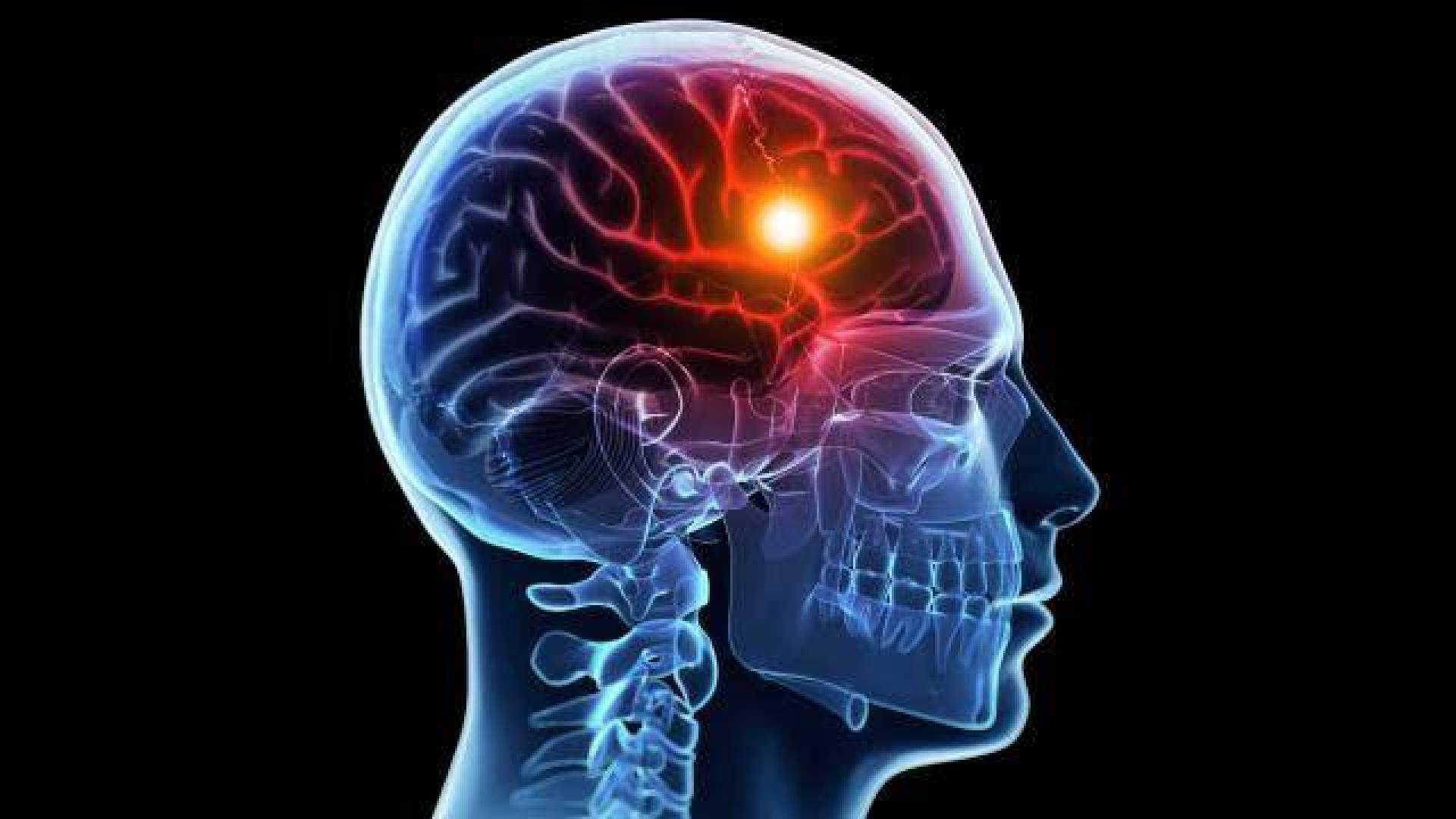 خلايا مناعية تحمي الدماغ مع تقدم مرض الزهايمر