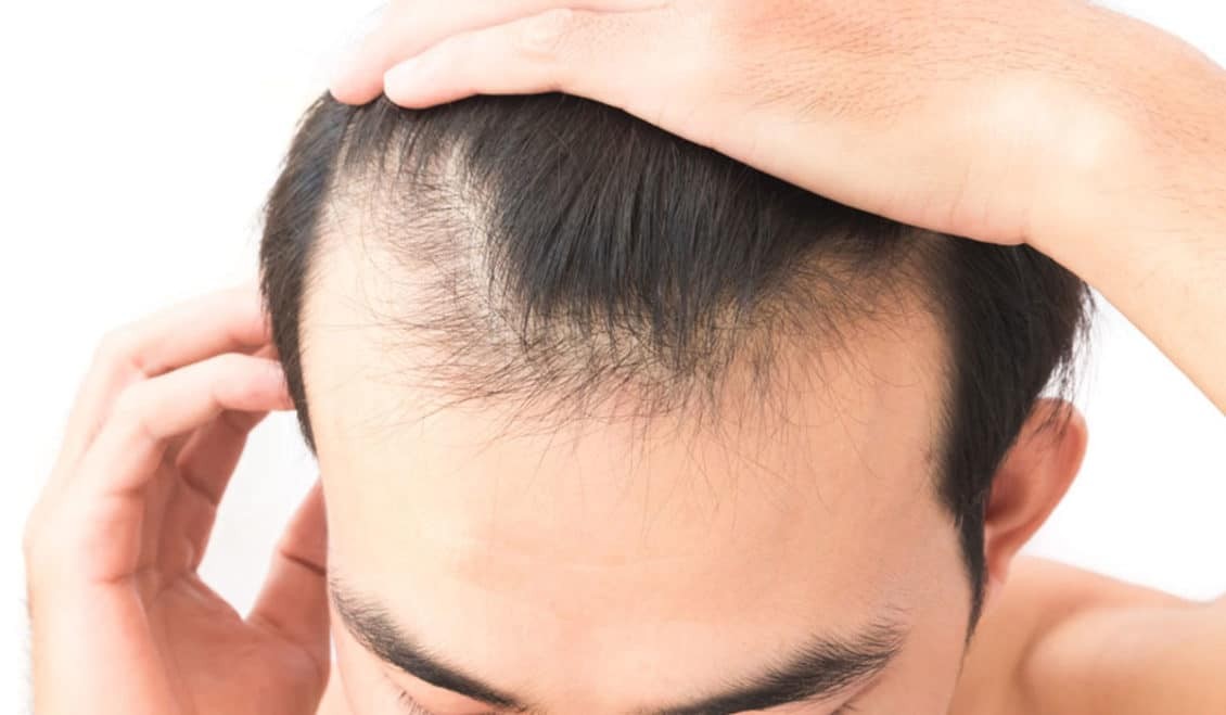 لن يتساقط شعرك بعد اليوم