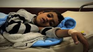 25 مريضاً يمنياً يموتون يومياً بسبب حصار التحالف السعودي