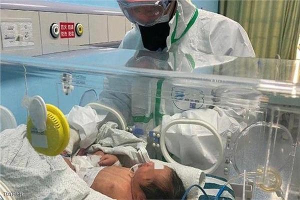 ولادة أول طفل في العالم مصاب بفيروس 