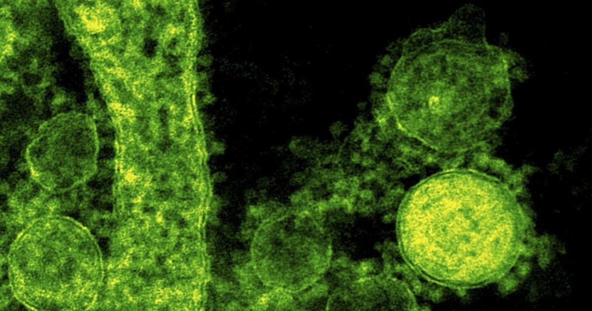 فيديو مذهل ..شاهد كيف يخترق فيروس 