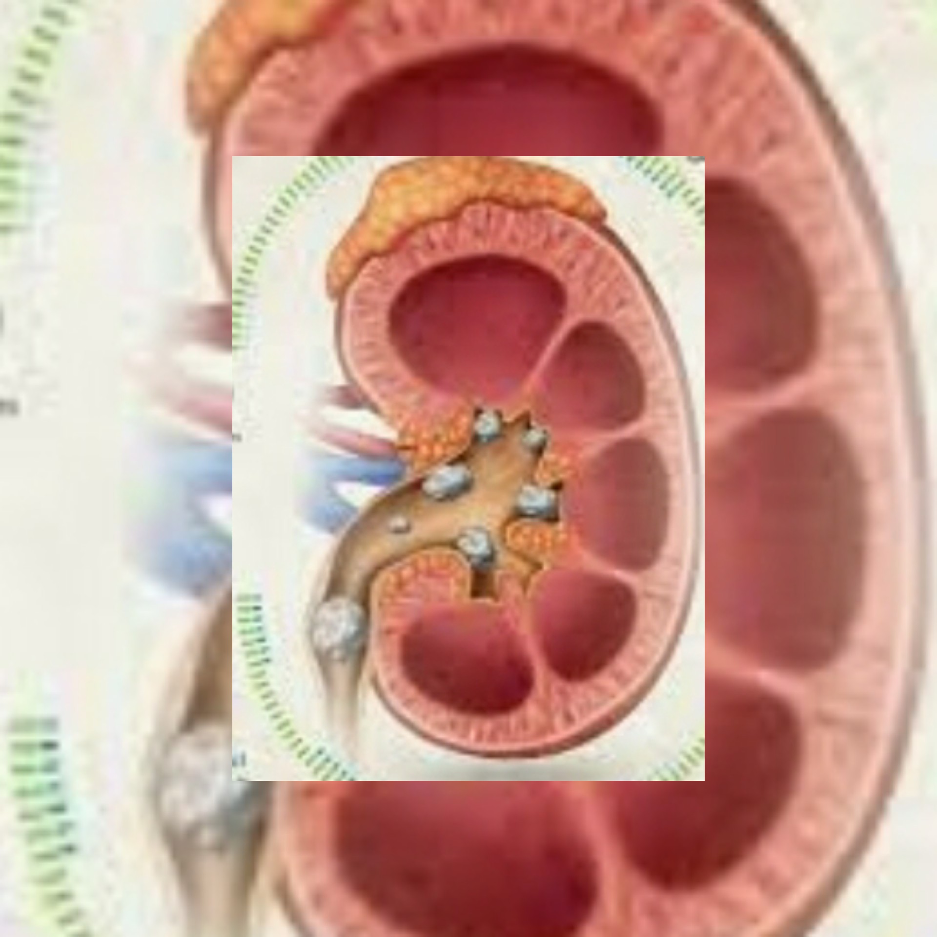 أطعمة تخفف من تشكل الحصى في أعضاء الجسم