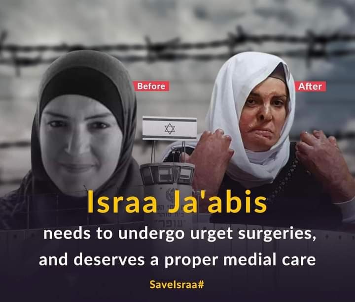 إدارة سجون الاحتلال تتعنت وترفض علاج الأسيرة إسراء الجعابيص بالرغم من خطورة وضعها الصحي
